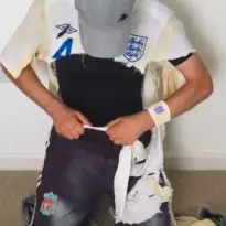 England lose to Iceland